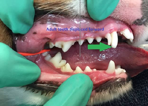 Persistent Deciduous Canine Tooth