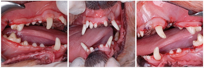Periodontal After